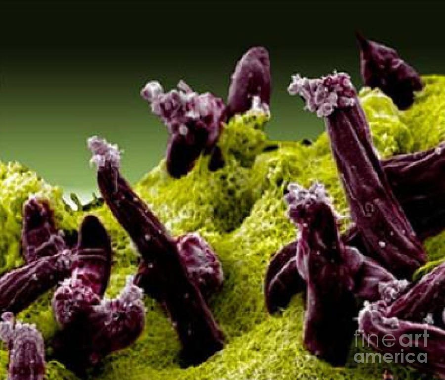 Plasmodium Gallinaceum, Sem #1 Photograph by Science Source
