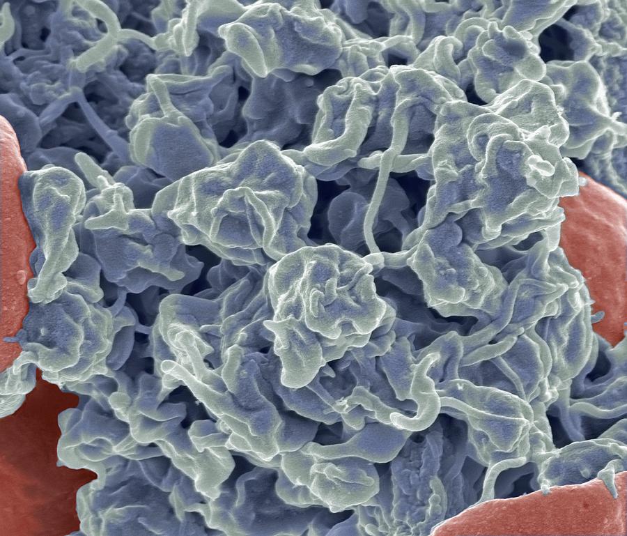 Biological Photograph - Platelets, Sem #1 by Steve Gschmeissner