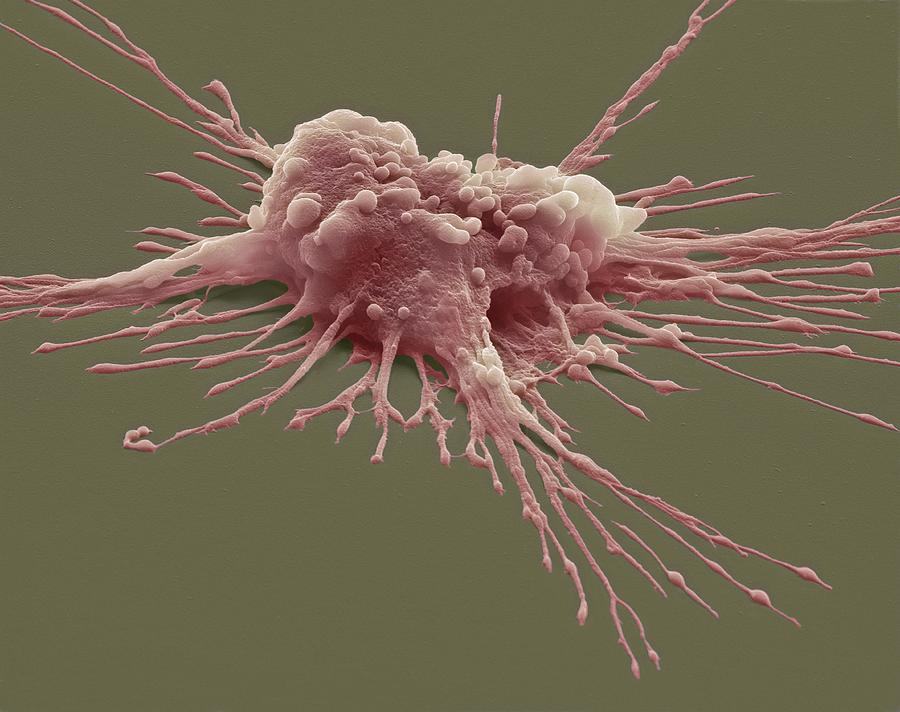 Pluripotent Stem Cell, Sem #1 by Steve Gschmeissner