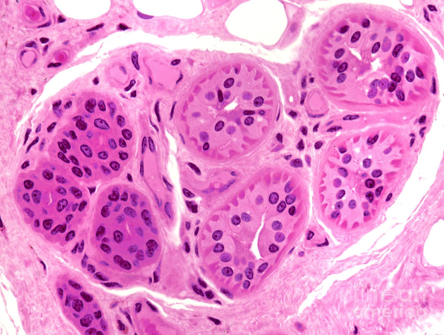 Primate Sweat Gland #1 Photograph by M. I. Walker