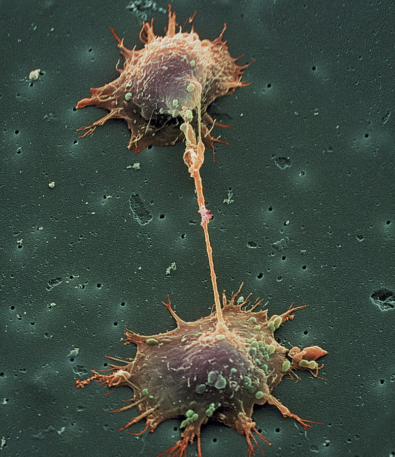 Prostate Cancer Cell Division Photograph By Steve Gschmeissner Fine Art America 0187