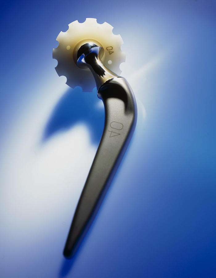 Prosthetic Hip Artificial Hip Joint Photograph By Tek Image