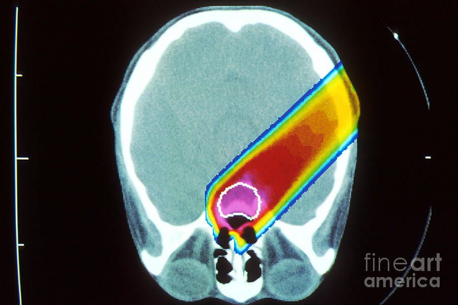 Proton Beam From Brain During Ct Scan #1 Photograph by Science Source