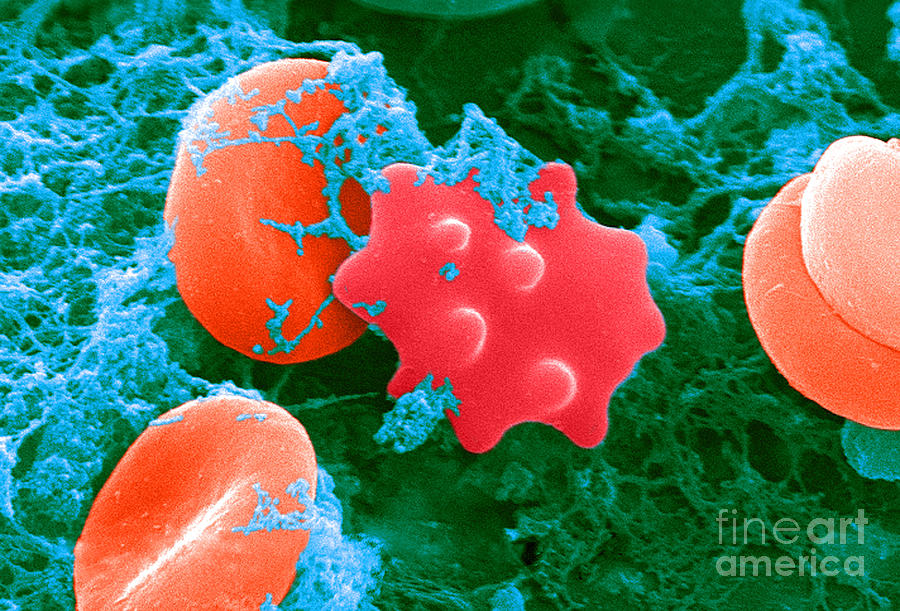 Red Blood Cells And Acanthocyte, Sem #1 Photograph by Science Source