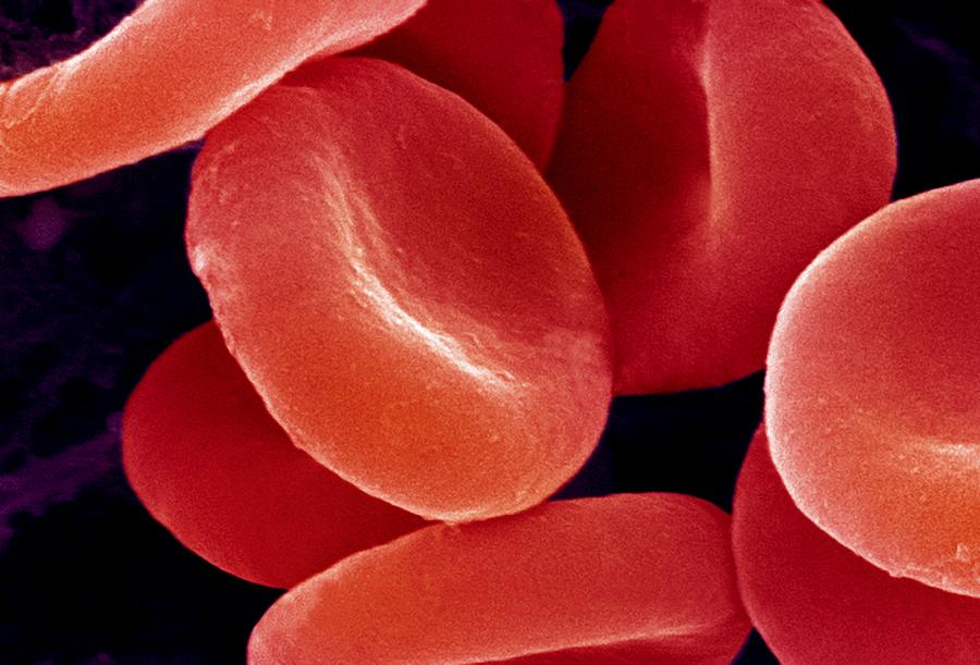 Erythrocyte Photograph - Red Blood Cells, Sem #1 by Ami Images