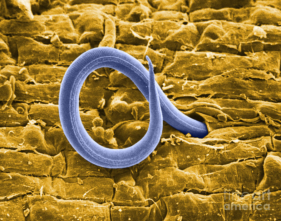Root Knot Nematode Sem #1 Photograph by Science Source