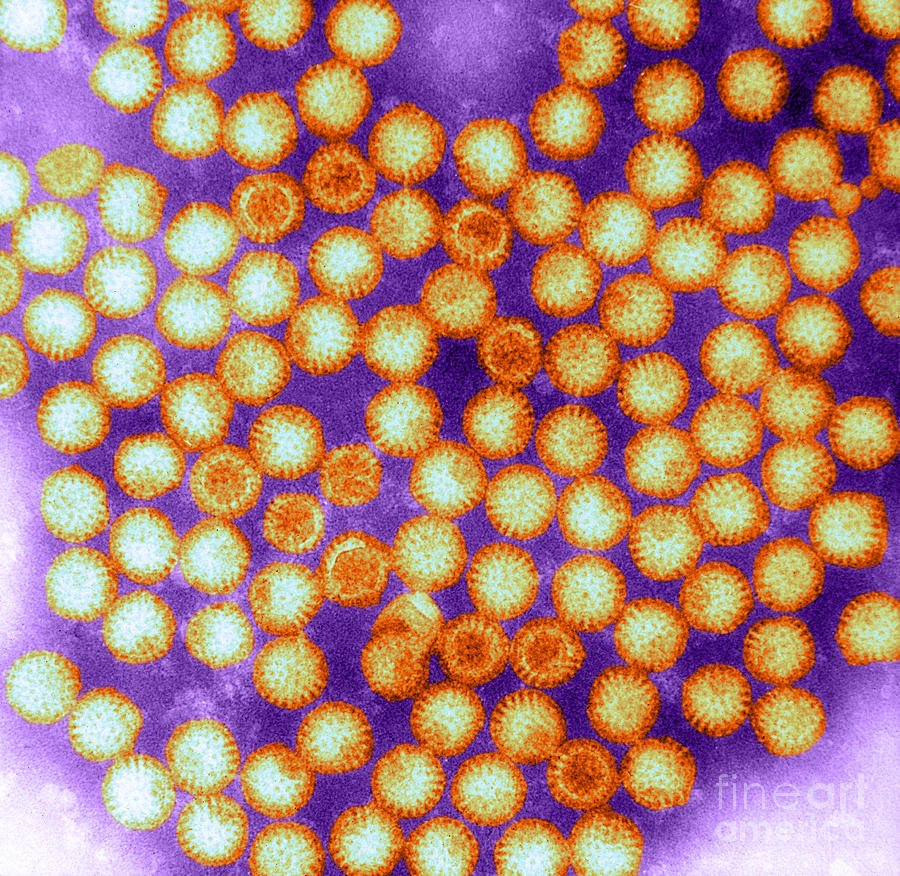 Rotavirus, Tem #1 Photograph by ASM/Science Source