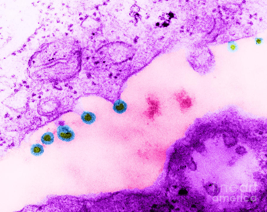 Rubella Virus German Measles, Tem #1  by Science Source