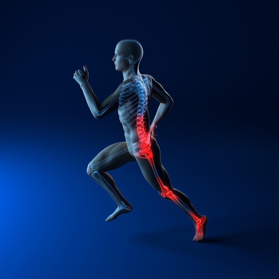 Skeleton Photograph - Running Injuries, Conceptual Artwork #1 by Sciepro