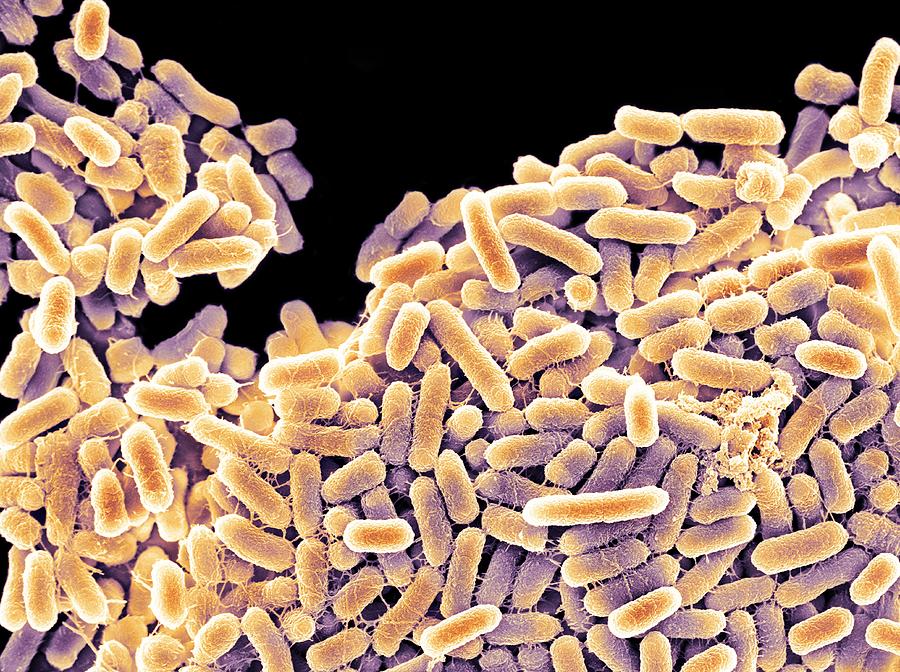 Salmonella Bacteria, Sem Photograph by - Pixels