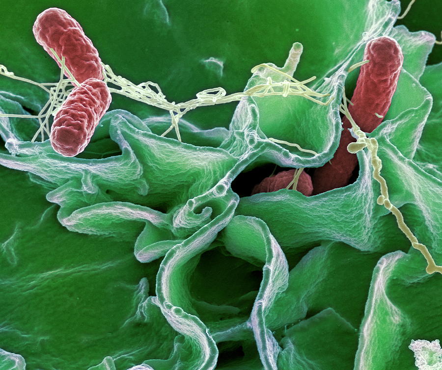 Salmonella Bacteria, Sem #1 Photograph by Niaidcdc
