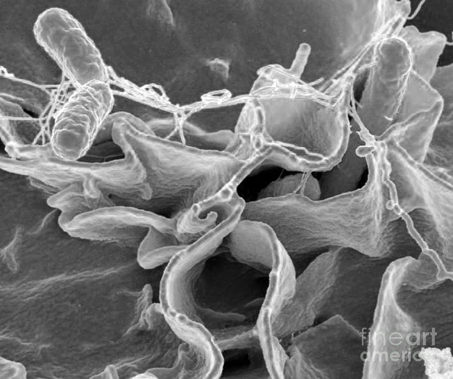 Salmonella Bacteria, Sem #1 Photograph by Science Source