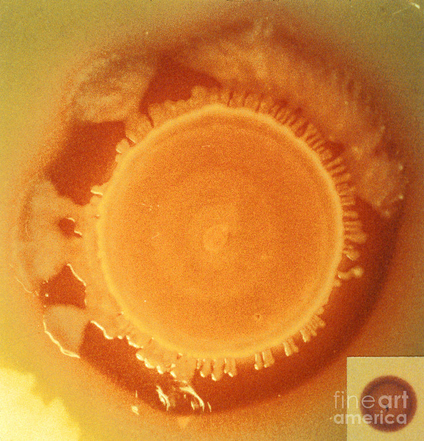 Salmonella Enteritidis #1 Photograph by Science Source