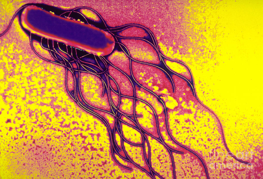 Salmonella #1 Photograph by Science Source