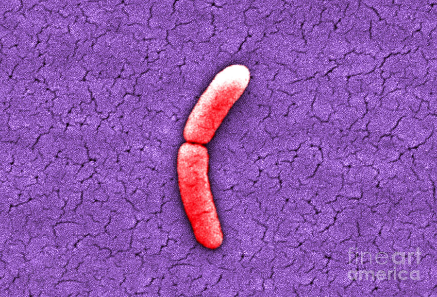 Salmonella, Sem #1 Photograph by Science Source