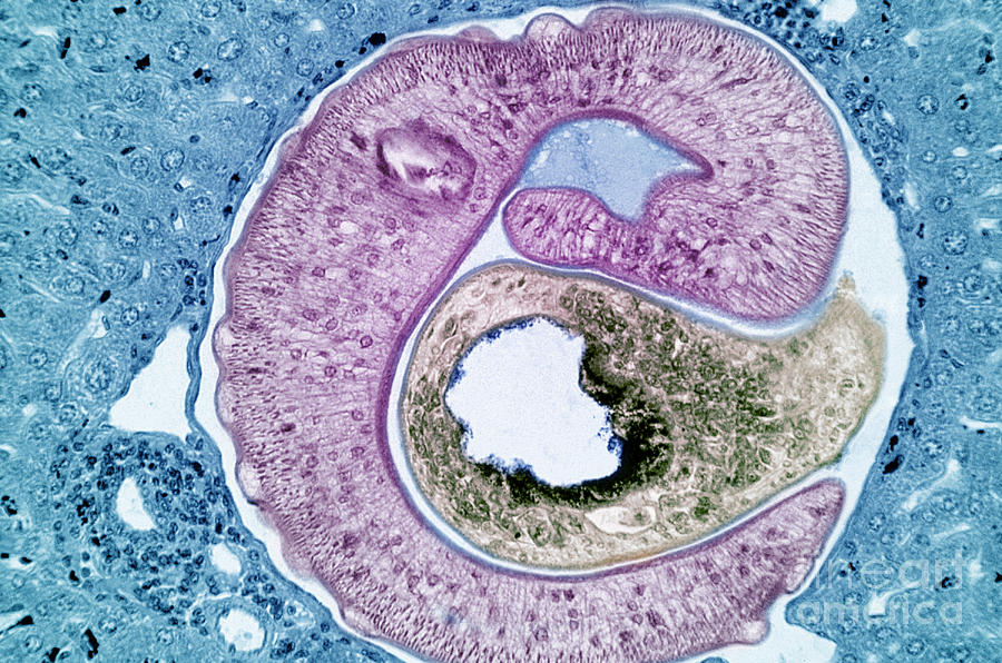 Schistosoma Mansoni #1 Photograph by M. I. Walker
