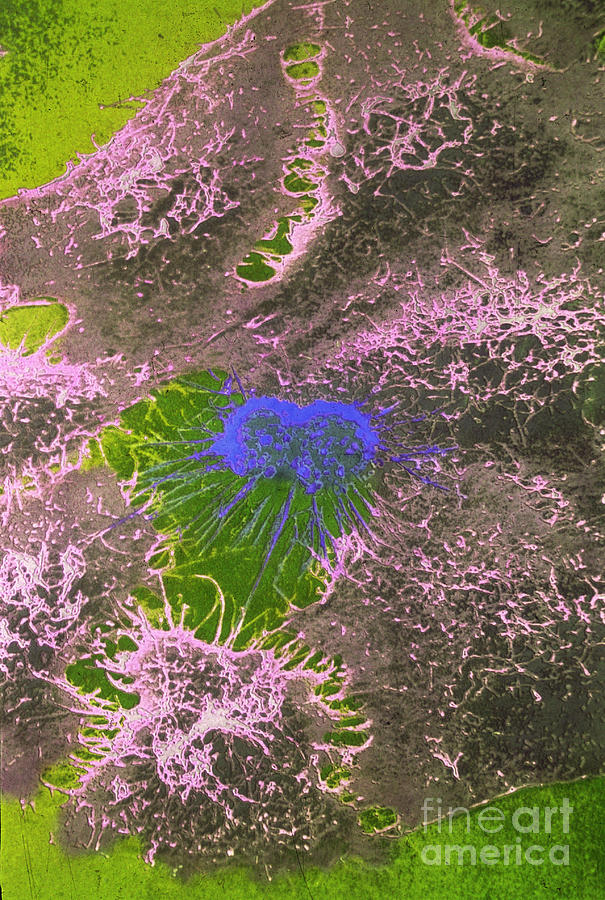 Sem, Hela Cells With Adenovirus #1 Photograph by Science Source