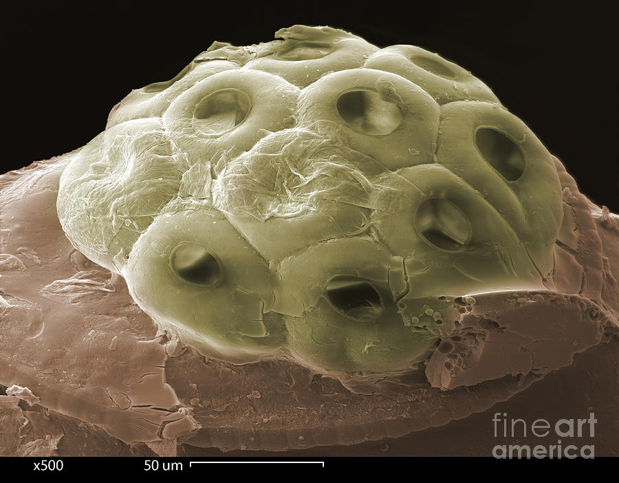 Animal Photograph - Sem Of A Head Lice Eggs #1 by Ted Kinsman