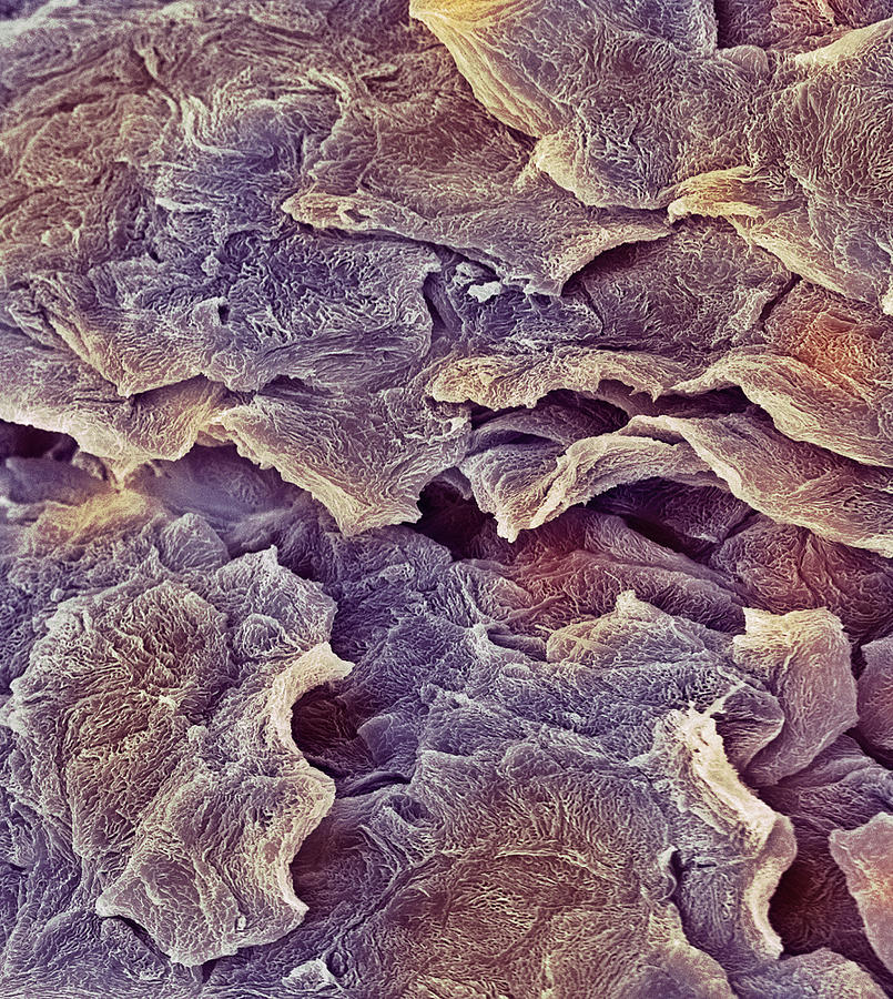 Squamous Photograph - Skin Surface, Sem #1 by Steve Gschmeissner