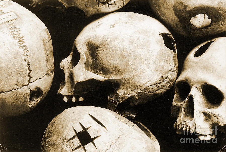 Skulls Showing Trepanation #2 Photograph by Science Source