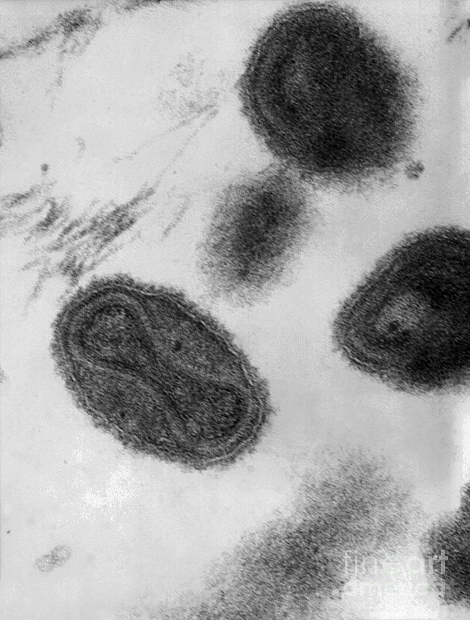 Smallpox Virus, Tem #1 Photograph by Science Source