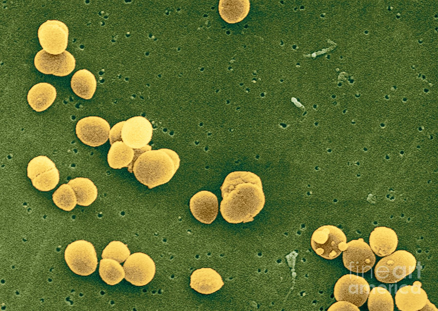 Staphylococcus Aureus Bacteria #1 Photograph by Science Source