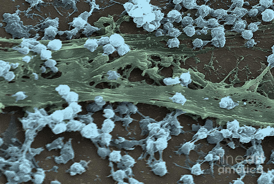 Staphylococcus Aureus Bacteria, Sem #1 Photograph by Science Source