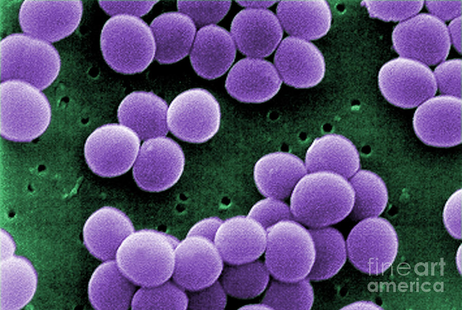 Staphylococcus Aureus #1 Photograph by Science Source