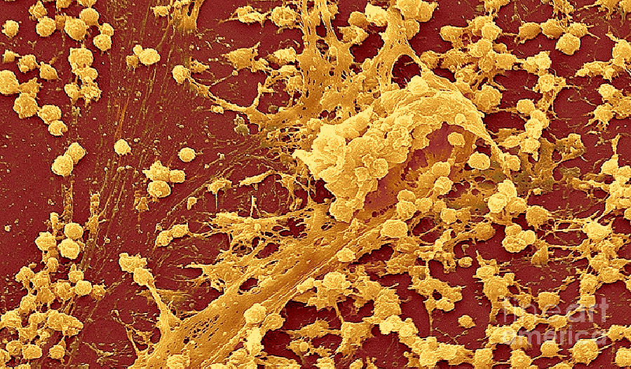 Staphylococcus Biofilm #1 Photograph by Science Source
