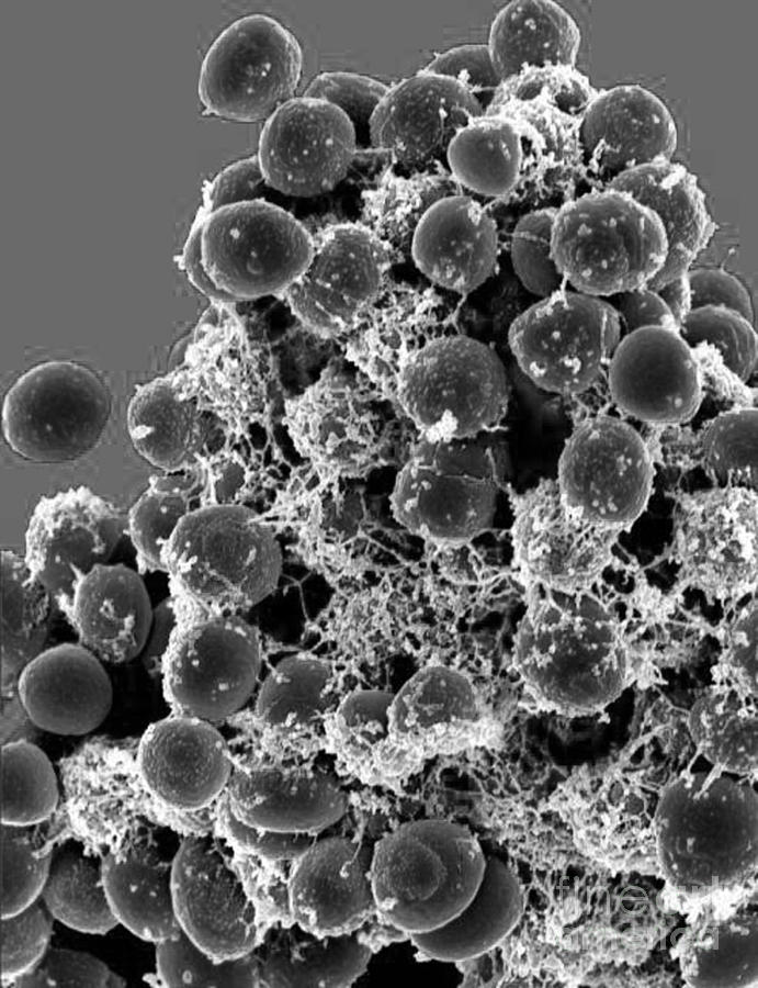 Staphylococcus Epidermidis Bacteria, Sem #1 Photograph by Science Source