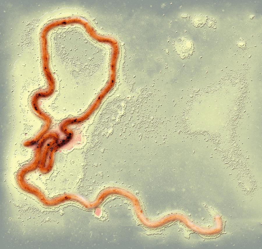 Syphilis Photograph - Syphilis Bacterium, Tem #1 by Ami Images