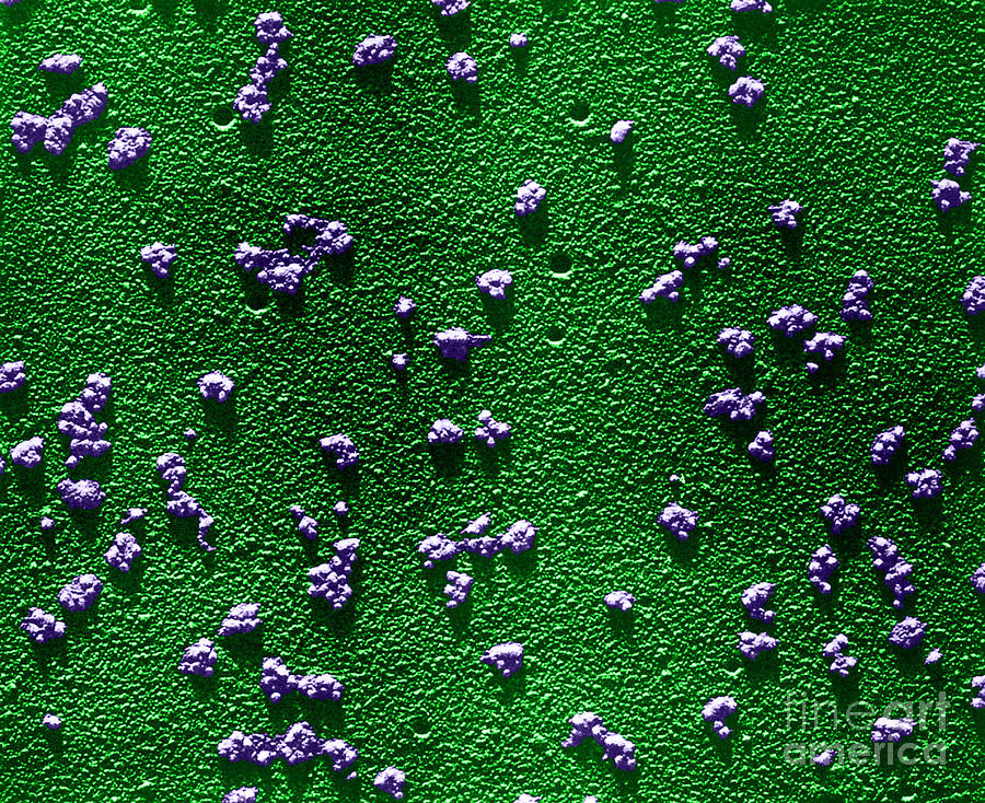Tem Of Reticulocyte Polyribosomes #3 Photograph by Omikron