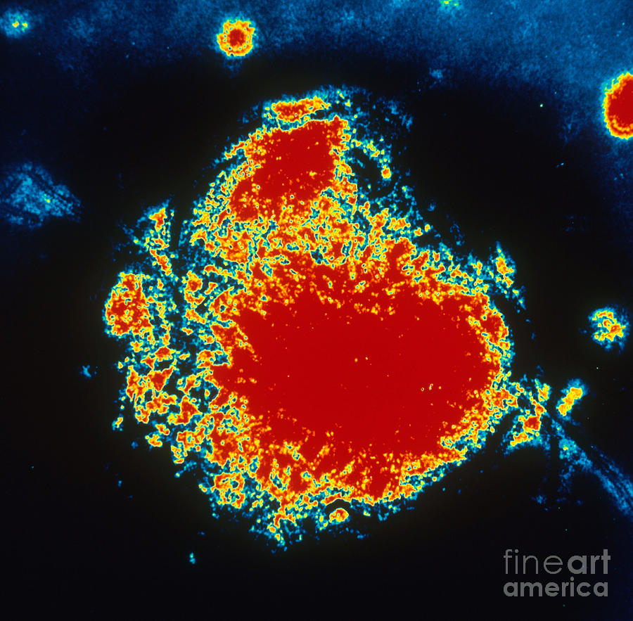 Tem Of Rubeola Measles Photograph by Science Source - Fine Art America