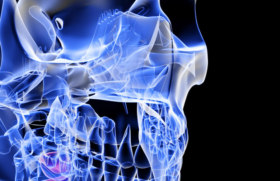 The Bones Of The Face Digital Art by MedicalRF.com The Bones Of The Face Digital Art by MedicalRF.com