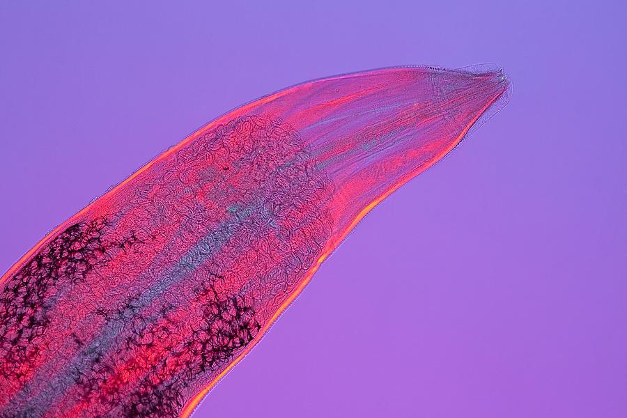 Threadworm, Light Micrograph 1 Photograph by Jerzy Gubernator Fine
