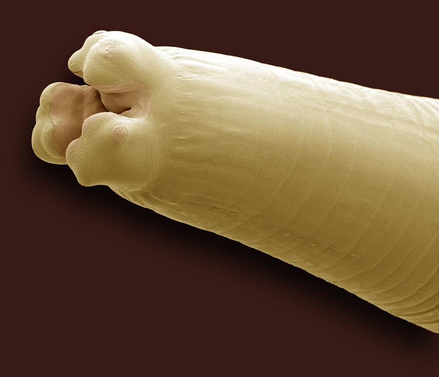 Threadworm, Sem Photograph by Steve Gschmeissner