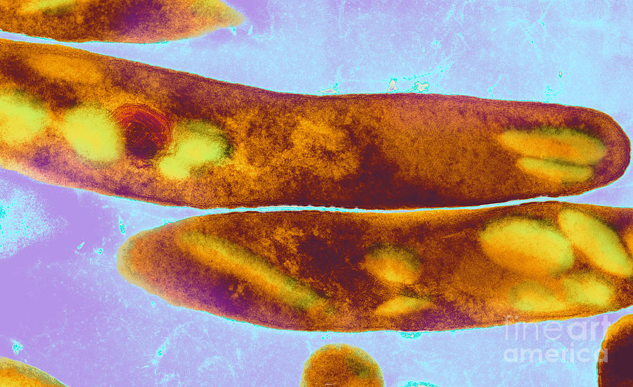 Tuberculosis Bacteria #1 Photograph by Science Source