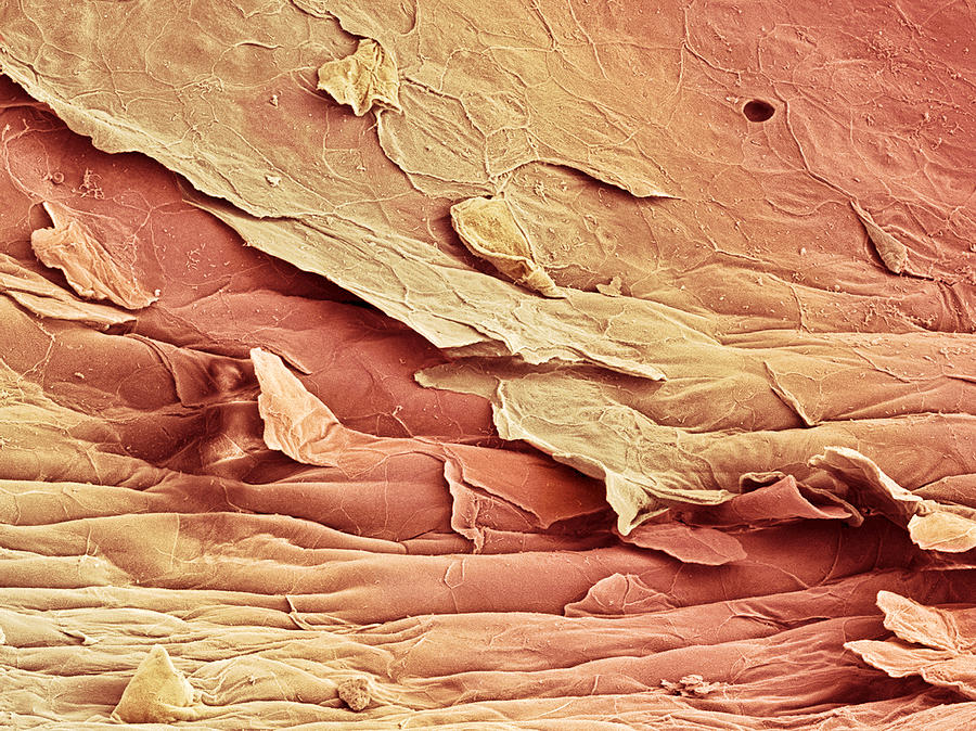Epithelium Photograph - Vaginal Lining, Sem #1 by Steve Gschmeissner