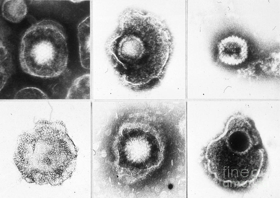 Black And White Photograph - Various Forms Of Herpes Simplex Virus #1 by Science Source