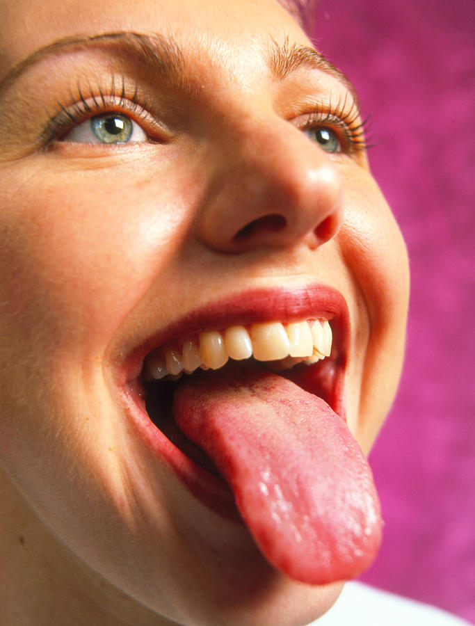 healthy tongue side