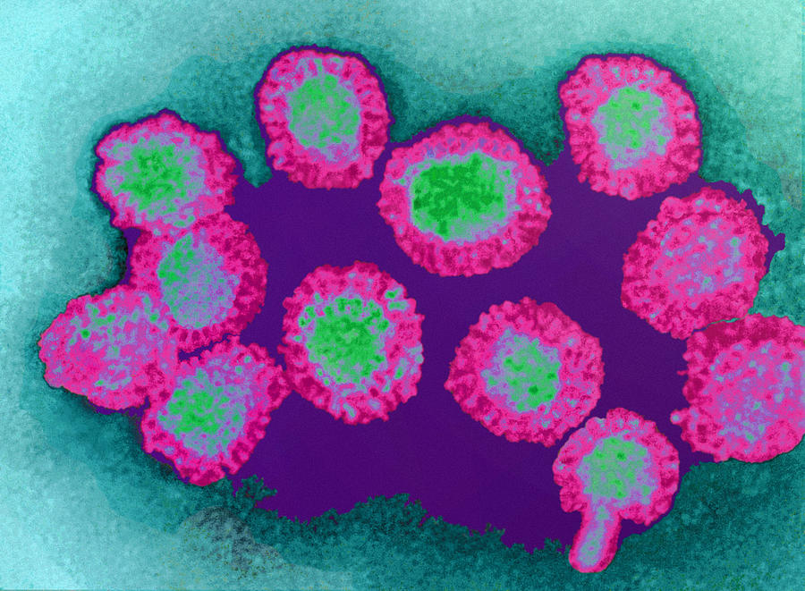 West Nile Virus Photograph - West Nile Viruses, Tem #1 by Dr Linda Stannard, Uct