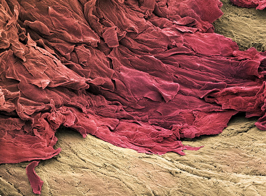 Wound Scab, Sem Photograph by Steve Gschmeissner - Pixels