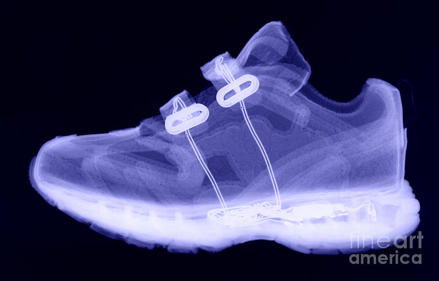X-ray Of Childs Shoe #1 Photograph by Ted Kinsman