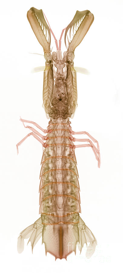 X-ray Of Mantis Shrimp #1 Photograph by Ted Kinsman