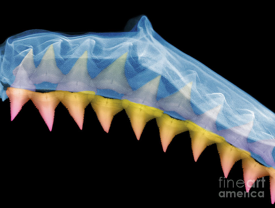 Jaws Photograph - X-ray Of Shark Jaws #6 by Ted Kinsman