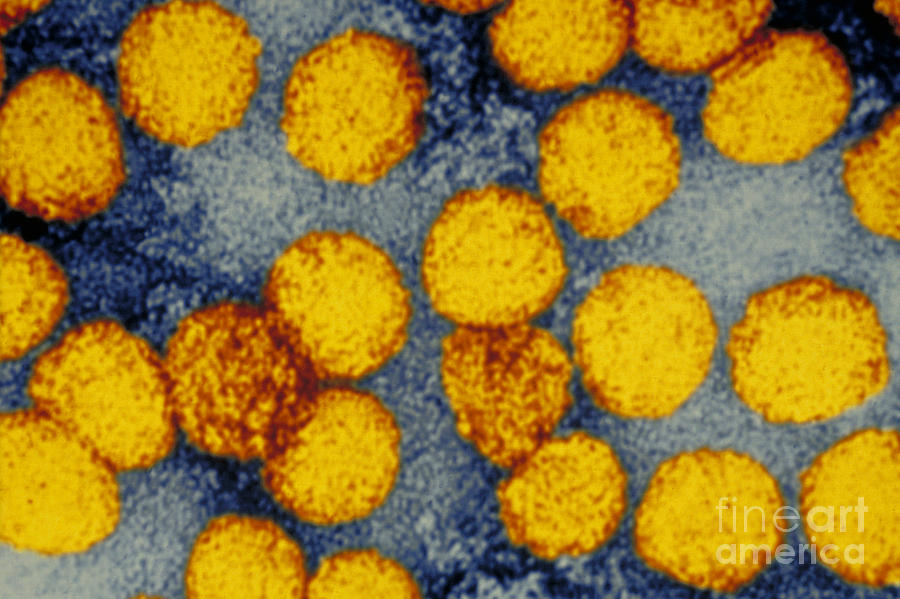 Yellow Fever Virus, Tem #1 Photograph by Science Source