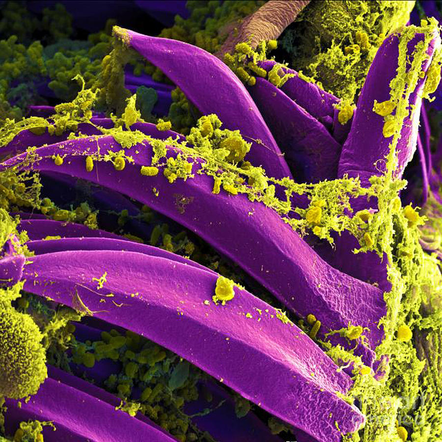 Microbiology Photograph - Yersinia Pestis Bacteria, Sem #1 by Science Source