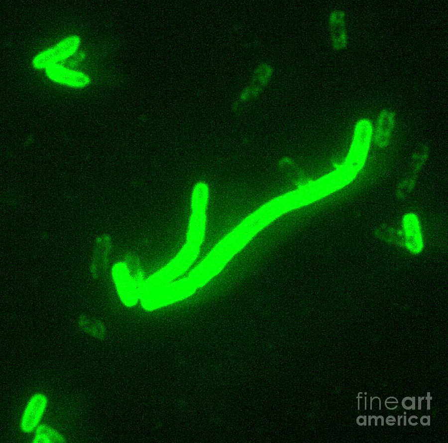 Dfa Photograph - Yersinia Pestis #1 by Science Source