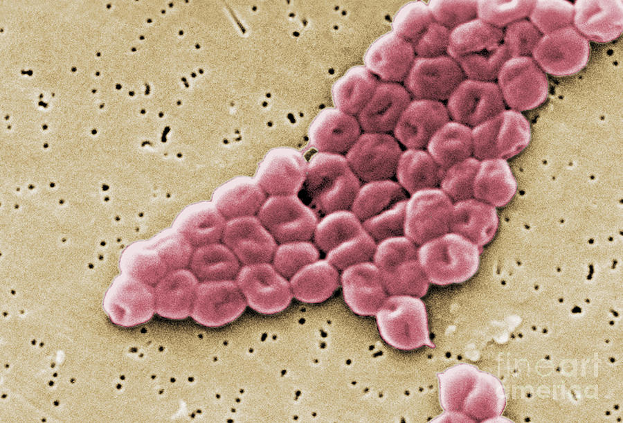 Acinetobacter Baumannii, Sem #10 Photograph by Science Source