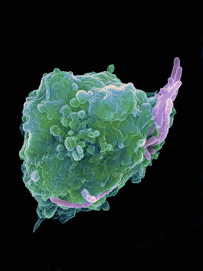 Mycobacterium Tuberculosis Photograph - Bacteria Infecting A Macrophage, Sem #10 by 